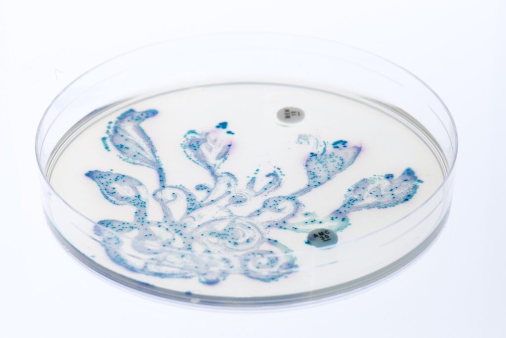 Image of gut microbiota grown on an agar plate with inhibitory antibiotics