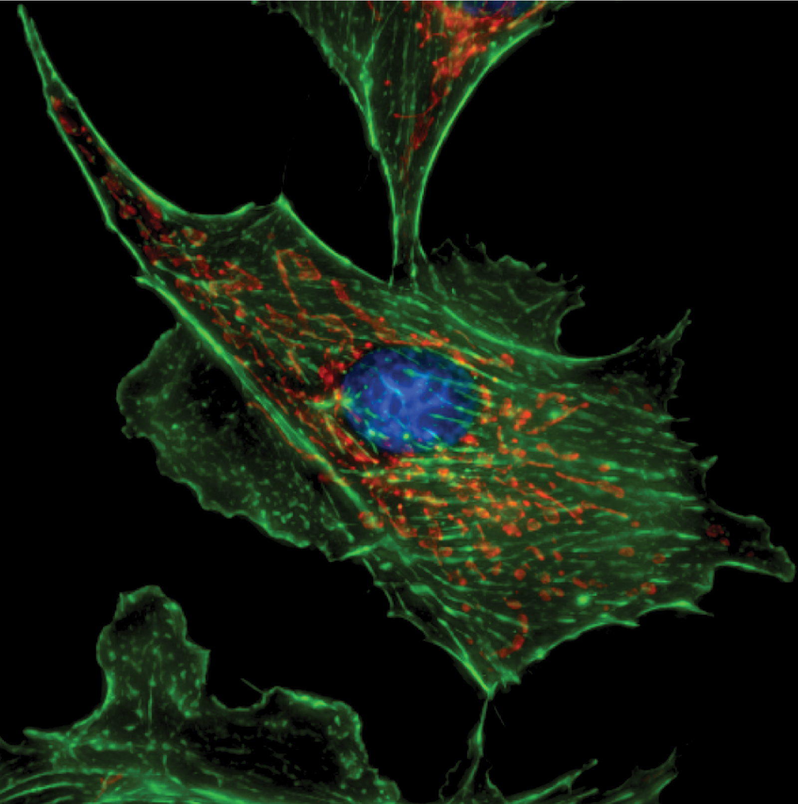 A fibroblast cell.